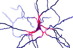 A Breakthrough Find that Has the Potential to Transform Neurodegenerative Disease Research